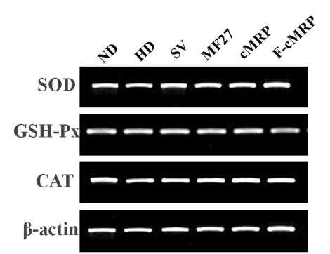 Hepatic mRNA expression by RT-PCR in different groups