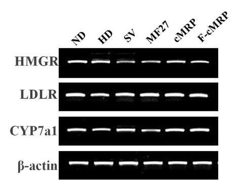 Hepatic mRNA expression by RT-PCR in different groups