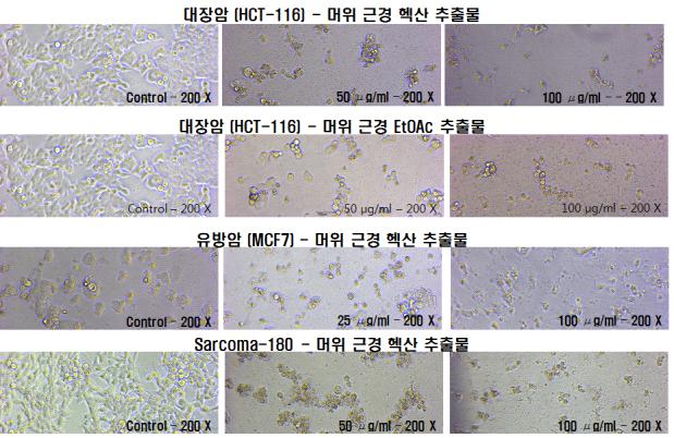 Rhizome extracts of P . japonicus induced morphological changes in HCT-116, MCF-7 and Sarcoma-180 cells (X 200).