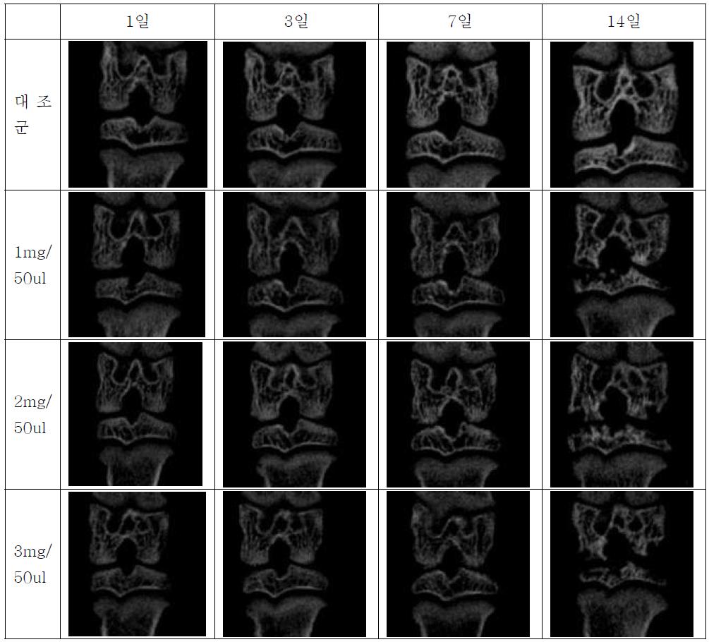 MIA 주사 2주 후 Micro CT Image 결과