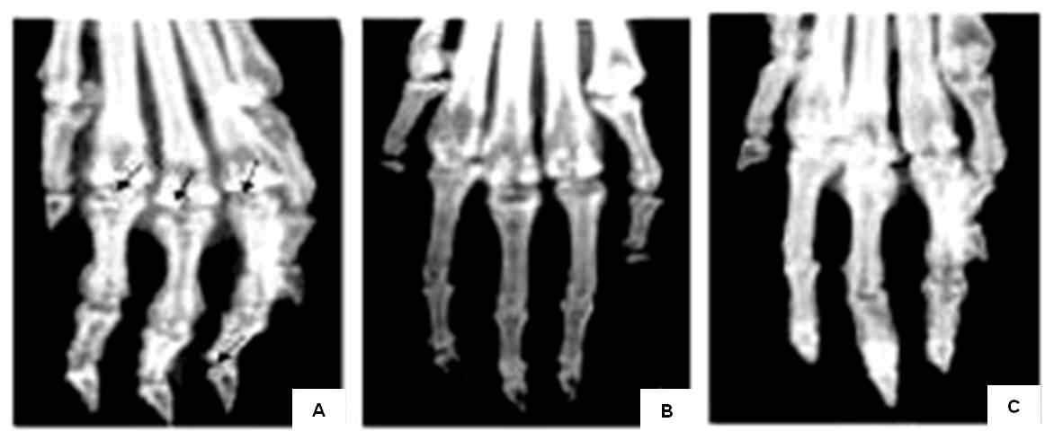 Radiographs of the hind paws of collagen-induced arthritis model mice.