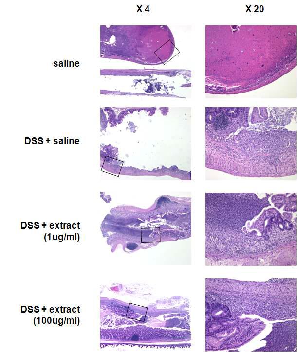 미선나무 추출물이 DSS에 의한 생쥐 대장 조직의 염증 손상에 미치는 영향