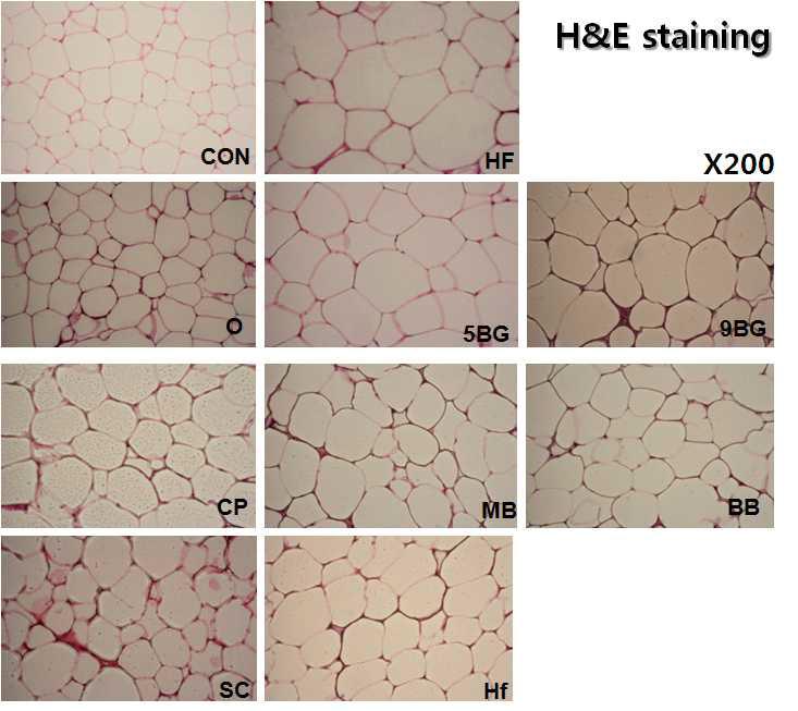 DIO mice의 fat pad에서 H&E staining(좌) & mast IHC(우) 결과