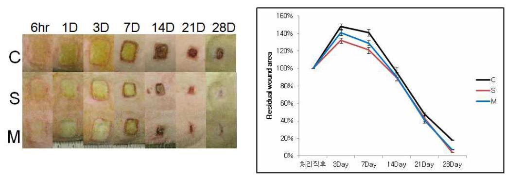 실크 피브로인 나노 스펀지폼에 의한 화상 치유 효과 관찰