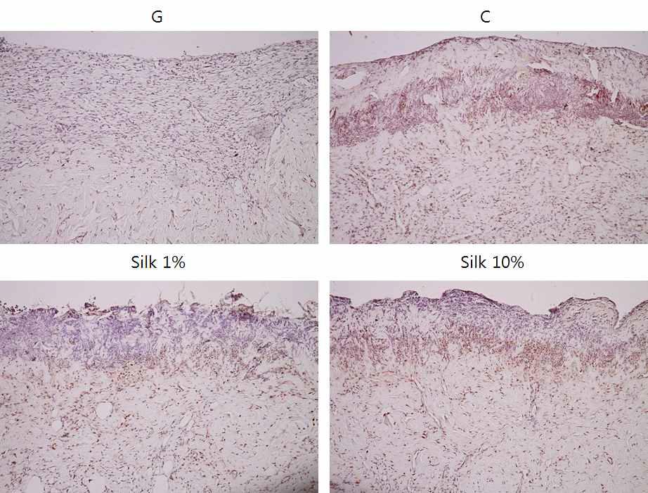 PCNA(proliferating cell nuclear antigen) 염색을 통한 피부 재생 확인.