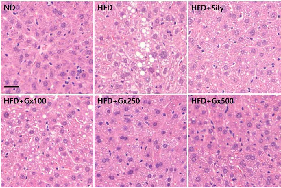 H&E staining of the liver tissues from different groups of mice.