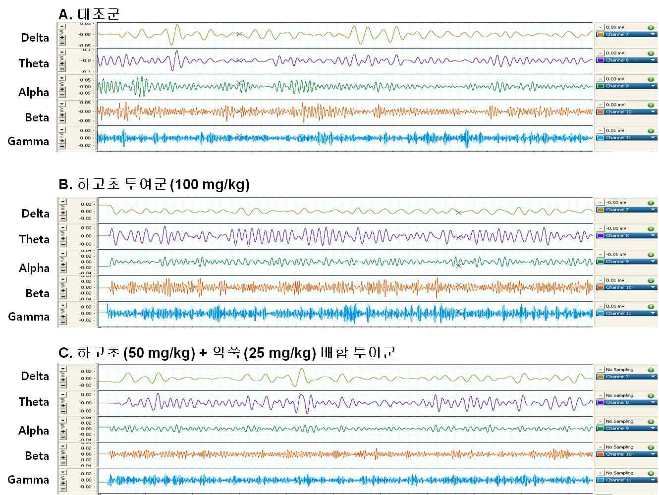 Representative EEG samples recorded after the 70% EtOH extract of Prunella vulgaris var. lilacina or the mixture extract of Prunella vulgaris var. lilacina and Artemisia princeps administration in rats