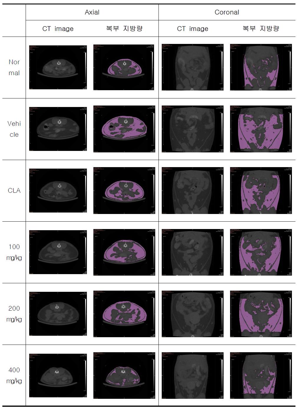 3주후 비만이 유도된 마우스에서의 복부지방 속 Micro CT Image 결과