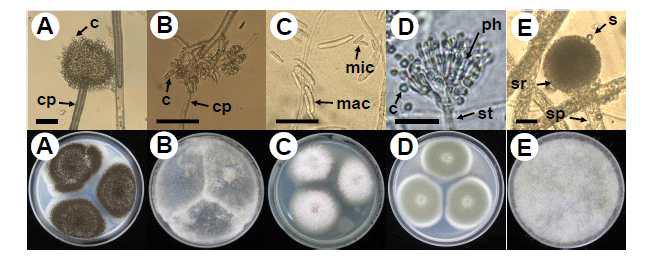 Morphologies of (A) the Aspergillus sp. F23, (B) Botrytis sp. F15, (C) Fusarium sp. F17, (D) Penicillium sp. F1, and (E) Rhizopus sp.