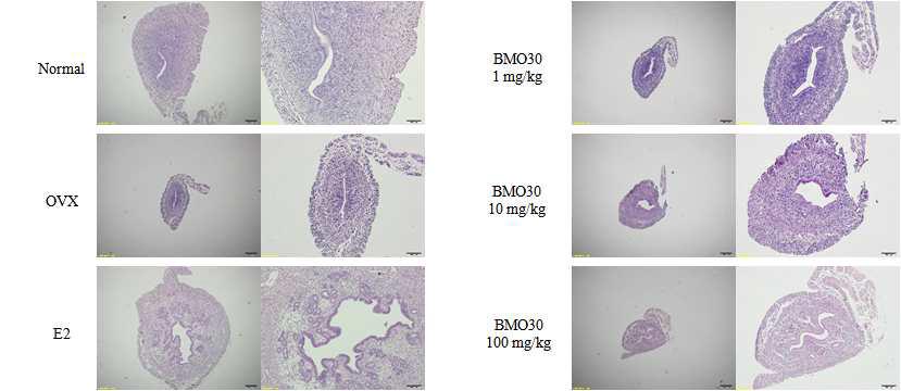 Effect of BMO-30 on uterus thickness