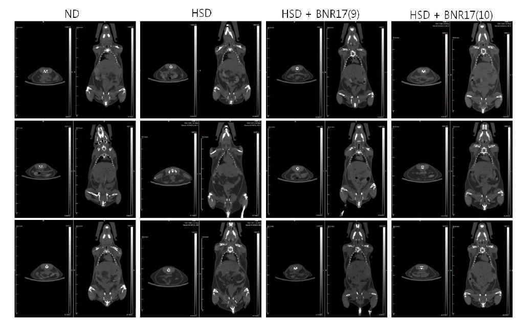 Representative CT scanning images of abdominal (left) and whole body (right) fat accumulation (in black) C57BL/6J mice.