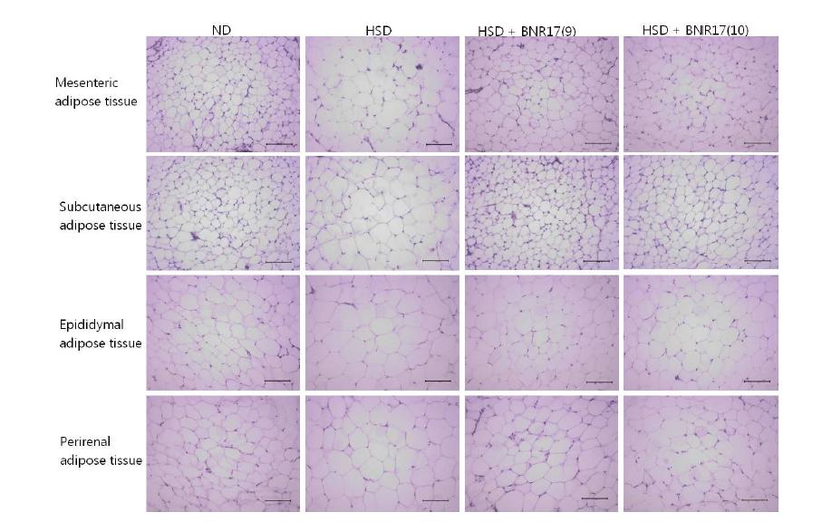 Representative adipose tissue staining images in C57BL/6J mice administered with ND, HSD or HSD containing Lb.gasseri BNR17 (109 CFU or 1010 CFU)for 10 weeks.