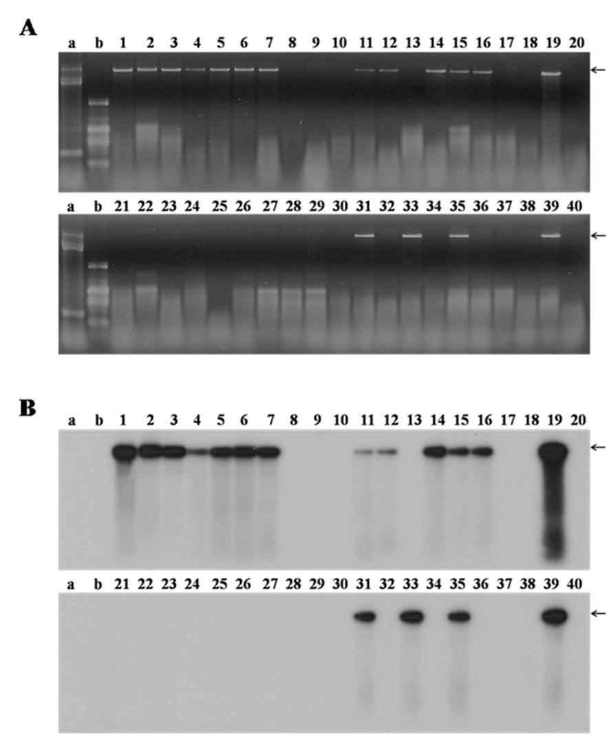 산조701-표고버섯바이러스 감염균주로부터 분리된 단핵균주들의 dsRNA 바이러스 존재여부 확인을 위한 Northern blot analysis