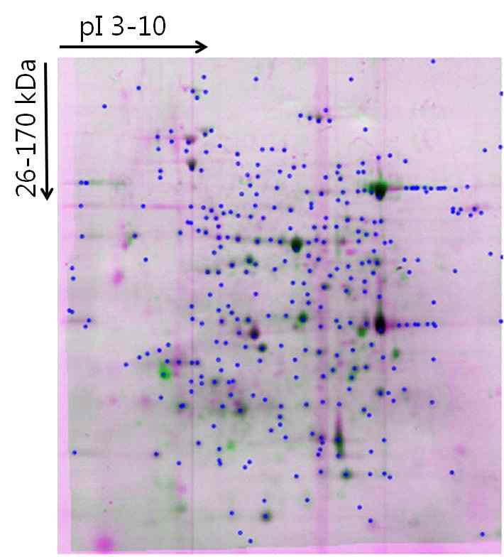 표고버섯바이러스 감염체와 비감염체의 2D-PAGE 수행 후 2 결과의 비교분석