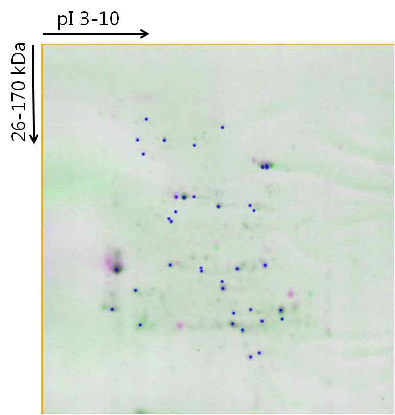느타리버섯바이러스 감염체와 비감염체의 2D-PAGE 수행 후 2 결과의 비교분석