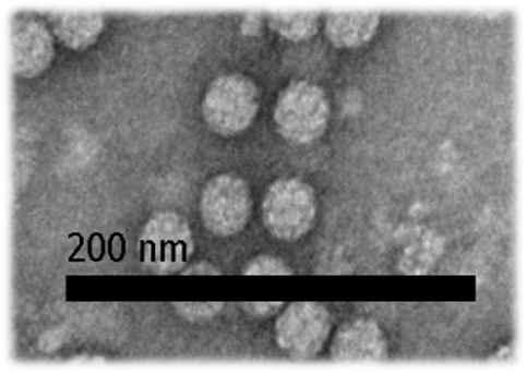 바이러스 전자 현미경 입자. 대략 28~30 nm의 구형 바이러스