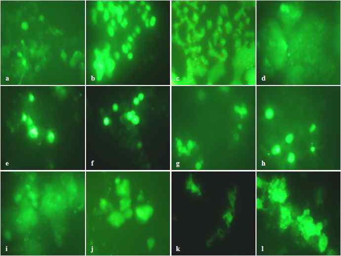 Levels of ROS damaged by Aβ(25-35) and protective effect of Tenebrio molitor fractions in PC12 cells. (a) Control, (b) 50 μM Aβ(25-35), (c) 50 μM Aβ (25-35) + 10 ㎍/ml EtOH, (d) 50 μM Aβ(25-35) + 50 ㎍/ml EtOH, (e) 50 μM Aβ(25-35) + 10 ㎍/ml Hexane, (f) 50 μM Aβ(25-35) + 50 ㎍/ml Hexane, (g) 50 μM Aβ(25-35) + 10 ㎍/ml EA, (h) 50 μM Aβ(25-35) + 50 ㎍/ml EA, (i) 50 μM Aβ(25-35) + 10 ㎍/ml BuOH, (j) 50 μM Aβ(25-35) + 50 ㎍/ml BuOH, (k) 50 μM Aβ(25-35) + 10 ㎍/ml H20, (l) 50 μM Aβ(25-35) + 50 ㎍/ml H2O.