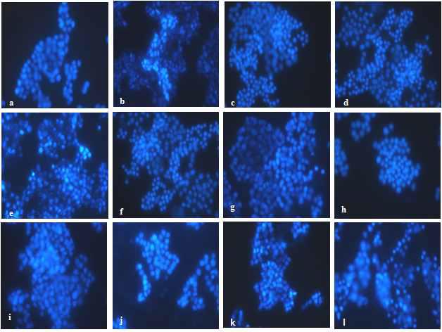 Microscopic analysis of solvent fractions from Tenebrio molitor on Aβ(25-35)- induced apotosis. Representative images of PC12 cells with Aβ(25-35) treatment in the presence or absence of solvent fractions from Tenebrio molitor. (a) Control, (b) 50 μM Aβ(25-35), (c) 50 μM Aβ(25-35) + 10 ㎍/ml EtOH, (d) 50 μM Aβ(25-35) + 50 ㎍/ml EtOH, (e) 50 μM Aβ(25-35) + 10 ㎍/ml Hexane, (f) 50 μM Aβ(25-35) + 50 ㎍/ml Hexane, (g) 50 μM Aβ(25-35) + 10 ㎍/ml EA, (h) 50 μM Aβ(25-35) + 50 ㎍/ml EA, (i) 50 μM Aβ(25-35) + 10 ㎍/ml BuOH, (j) 50 μM Aβ(25-35) + 50 ㎍/ml BuOH, (k) 50 μ M Aβ(25-35) + 10 ㎍/ml H20, (l) 50 μM Aβ(25-35) + 50 ㎍/ml H2O.