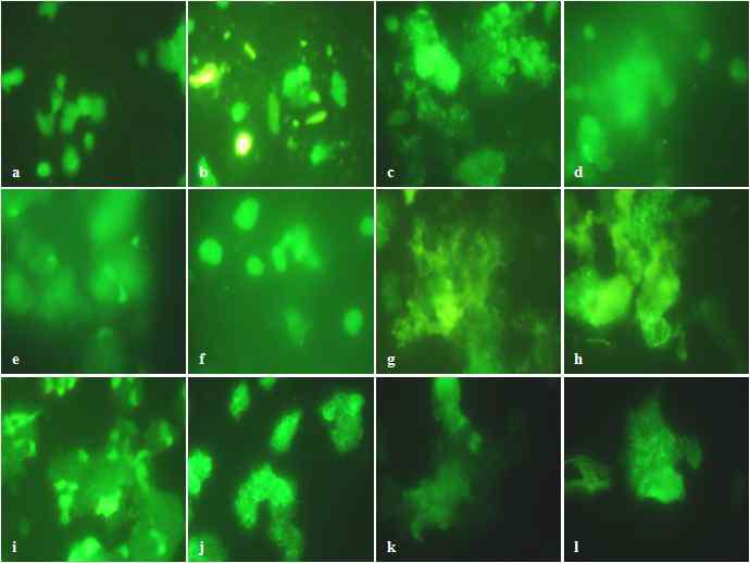 Levels of ROS damaged by Aβ(25-35) and protective effect of Protaetia brevitarsis fractions in PC12 cells.