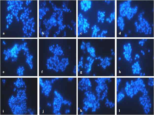 Microscopic analysis of solvent fractions from Protaetia brevitarsis on Aβ (25-35)- induced apotosis. Representative images of PC12 cells with Aβ(25-35) treatment in the presence or absence of solvent fractions from Protaetia brevitarsis