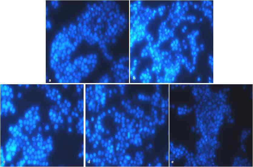 Microscopic analysis of oleic acid on Aβ(25-35)-induced apotosis. Representative images of PC12 cells with Aβ(25-35) treatment in the presence or absence of oleic acid.