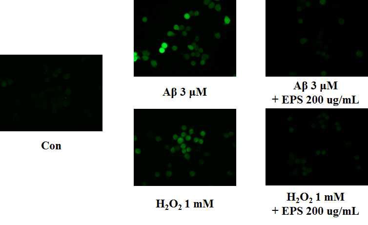 EPS prevents Aβ and H2O2-induced accumulation of intracellular ROS in SH-SY5Y cells