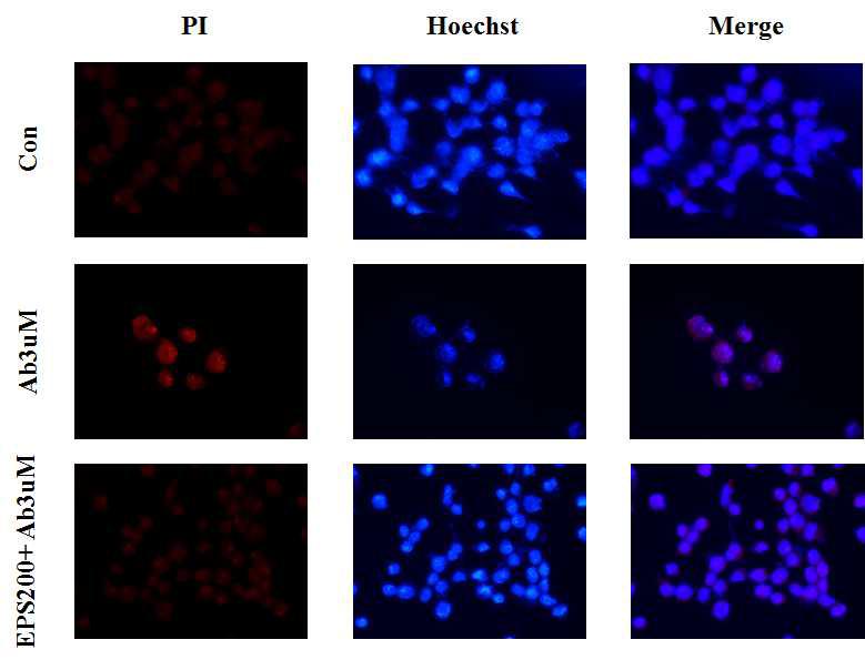 EPS prevents Aβ-induced accumulation of Nuclear changes in SH-SY5Y cells. In addition, nuclear abnormalities were assayed using Hoechst 33342 and PI fluorescent dyes, respectively.