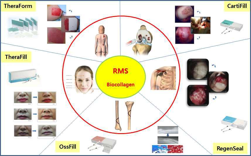 세원셀론텍의 다양한 적응증에 적용되고 있는 콜라겐 제품군;