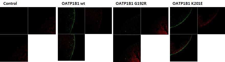 OATP1B1 유전자의 야생형과 신규 변이형 OATP1B1-G192R 와 OATP1B1-K201E에 대한 알세포의 세포막 단백발현 결과
