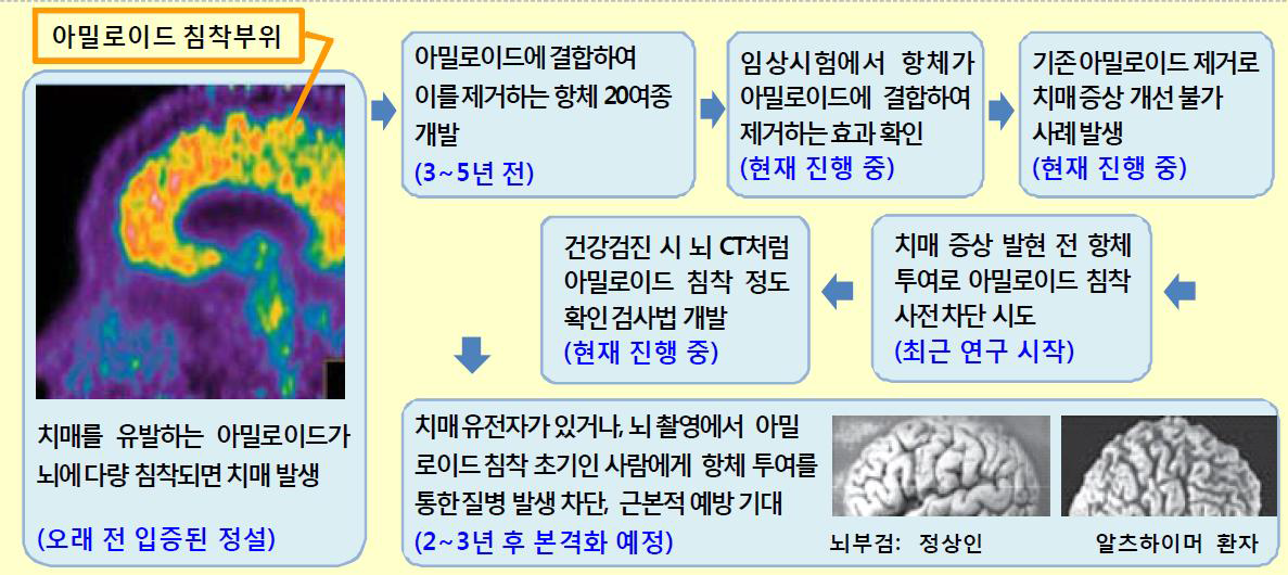 치매(알츠하이머병) 치료제의 연구개발기전