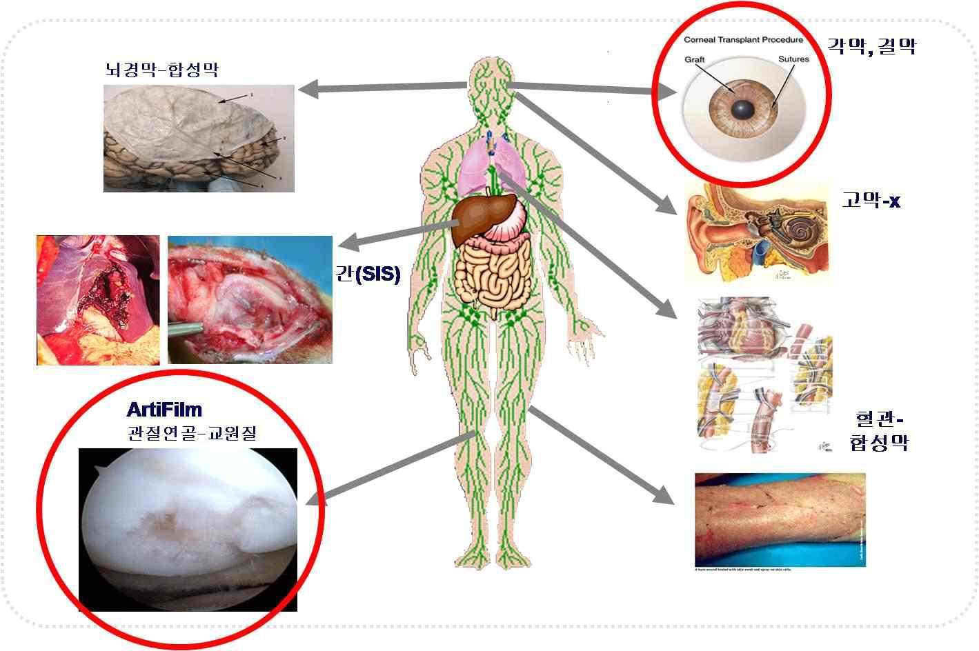 천연 생체막의 적용이 가능한 조직