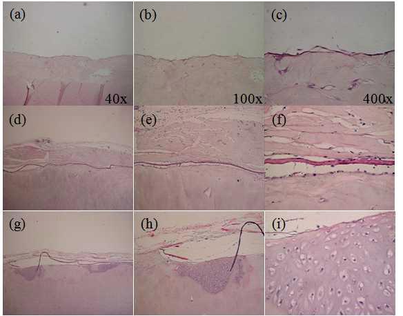 누드마우스에 이식한 부분층 연골 결손모델의 이식 4주 후의 H&E 염색. 대조군으로는 결손군(a), (b), (c)이 이용되었으며 실험군으로 ArtiFilm®군(d), (e), (f)과 연골세포가 부착된 ArtiFilm군(g), (h), (i)가 이식됨