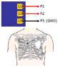 EKG 측정 방법