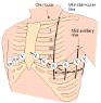 흉부전극부착부위