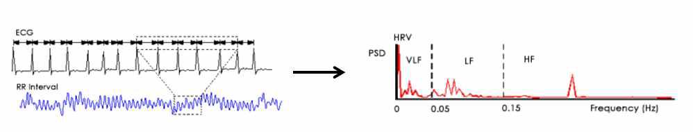 HRV 신호