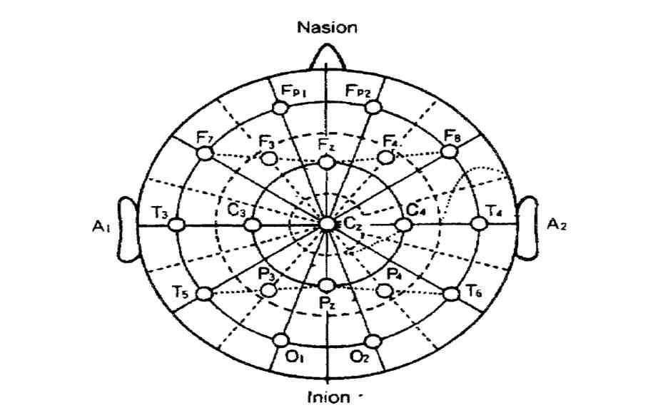 뇌파 측정 부위