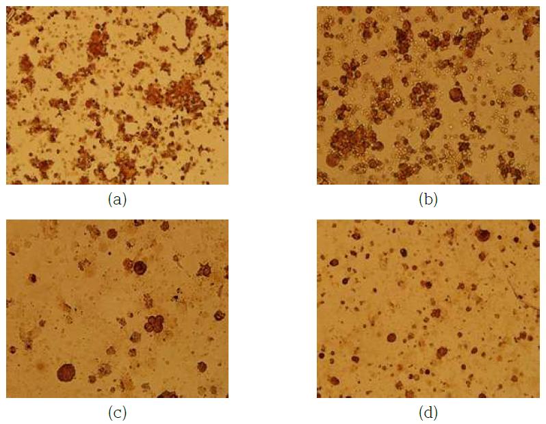 Anti Cytoskeratin Stain을 통한 Primary Tumor Cell 유무 확인