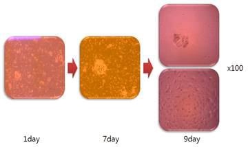 Case #1에서 Primary Tumor Cell 성장 관찰