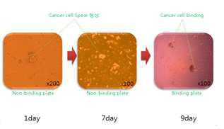 Case #2에서 Primary Tumor Cell 성장 관찰