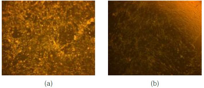 Case #3에서 배양된 섬유아세포 이미지 (×40)