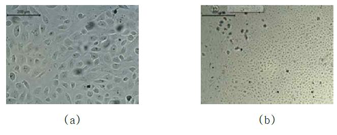 Case #11에서 배양된 Primary Tumor Cell 관찰