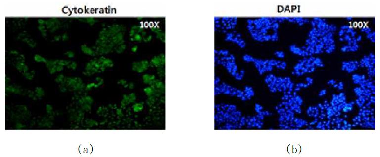 종양세포마커인 Cytokeratin 형광염색