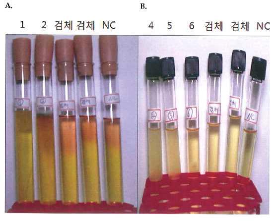 무혈청․무항생제 간엽줄기세포 배양액의 직접법을 이용한 무균 시험 A: 액상티오글리콜산배지, B: 대두카제인소화배지 1. Staphylococcus aureus, 2. Pseudomonas aeruginosa, 4. Bacillus albicans, 5. Candida albicans 검체: 무혈청․무항생제 간엽줄기세포 배양액, NC: 음성대조군