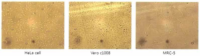 HeLa, Vero c1008, MRC-5의 morphology