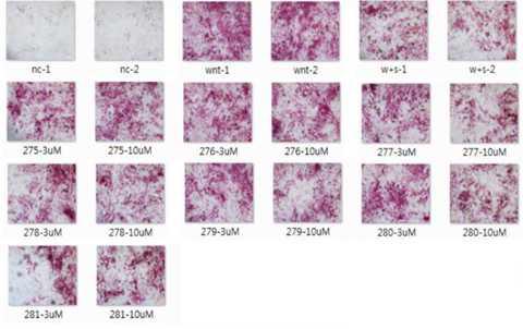 ST2 cell을 이용한 ALP 발현 실험. KY-06275~06281. nc : negative control, wnt : Wnt3A, w+s: Wnt3A + hSOST