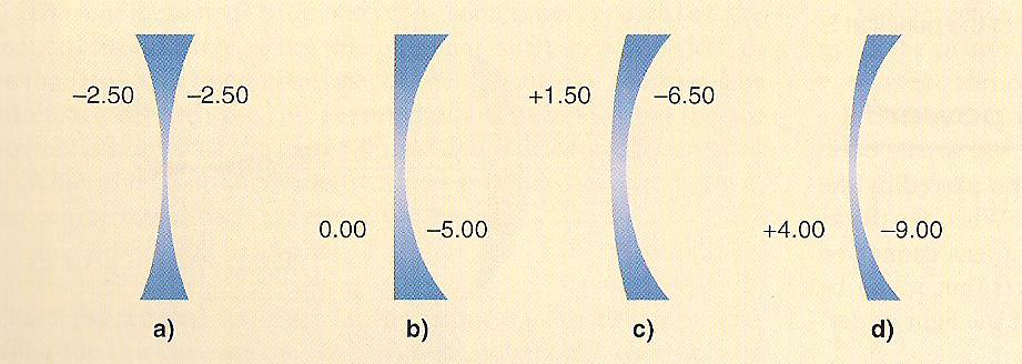 다양한 형태의 -5.00 D 렌즈