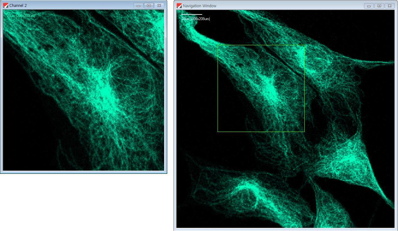 네비게이션 윈도우 기능 (우측의 표시된 사각형부분 스캔영상이 좌측 영상임)