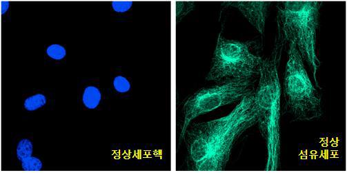 정상 세포핵과 정상 섬유 세포의 분리 영상