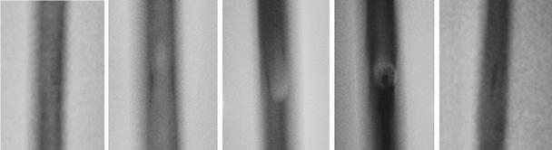 용접결함 Radiographic Testing 사진