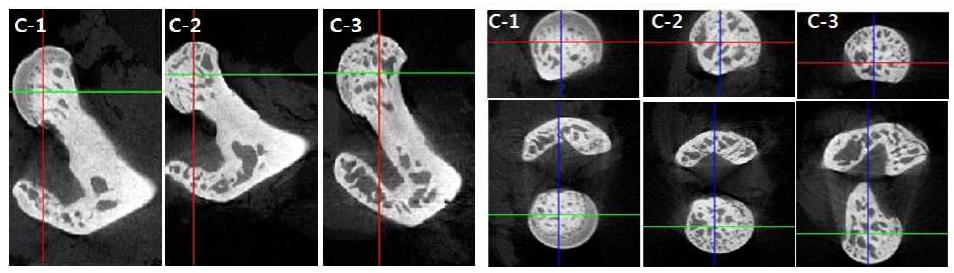 정상마우스의 대퇴골두에서의 Micro-CT결과